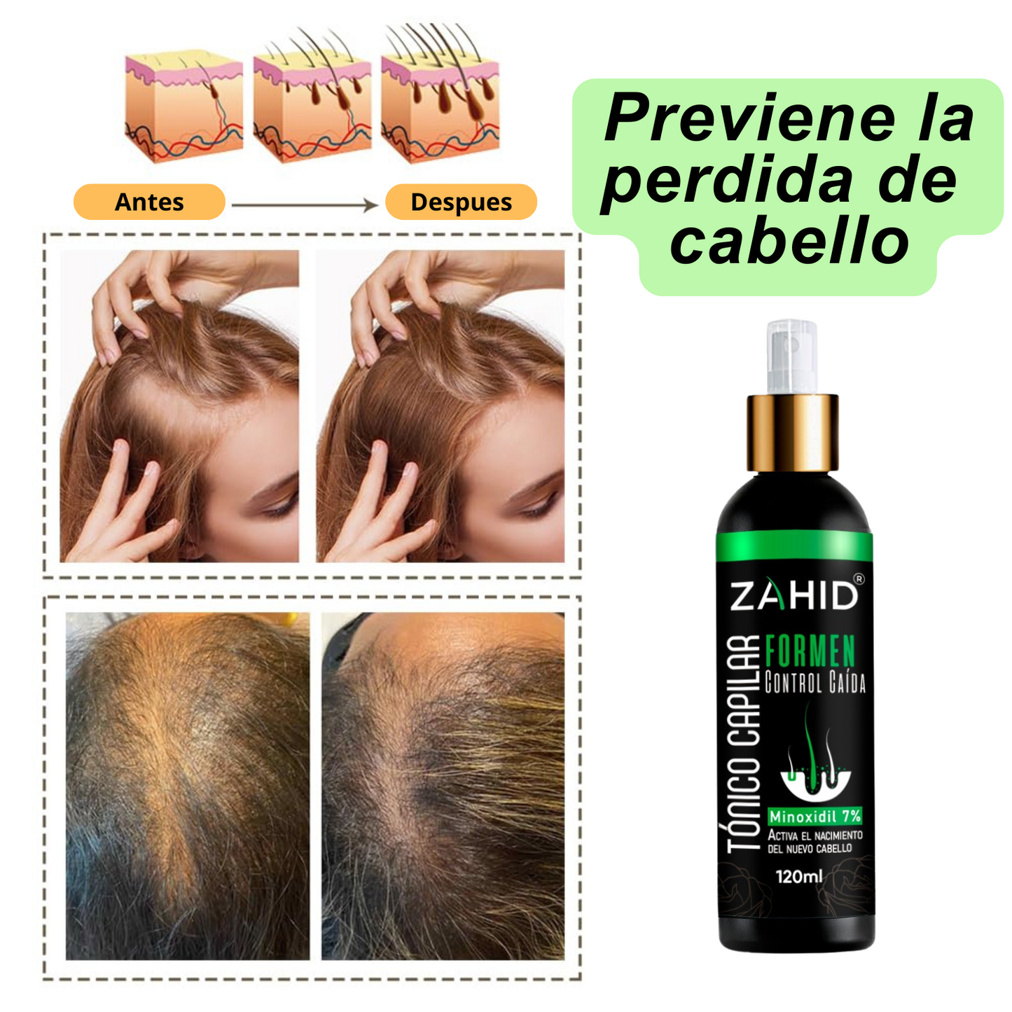 REVITALIZADOR ZAHID HAIRFORCE® MAX