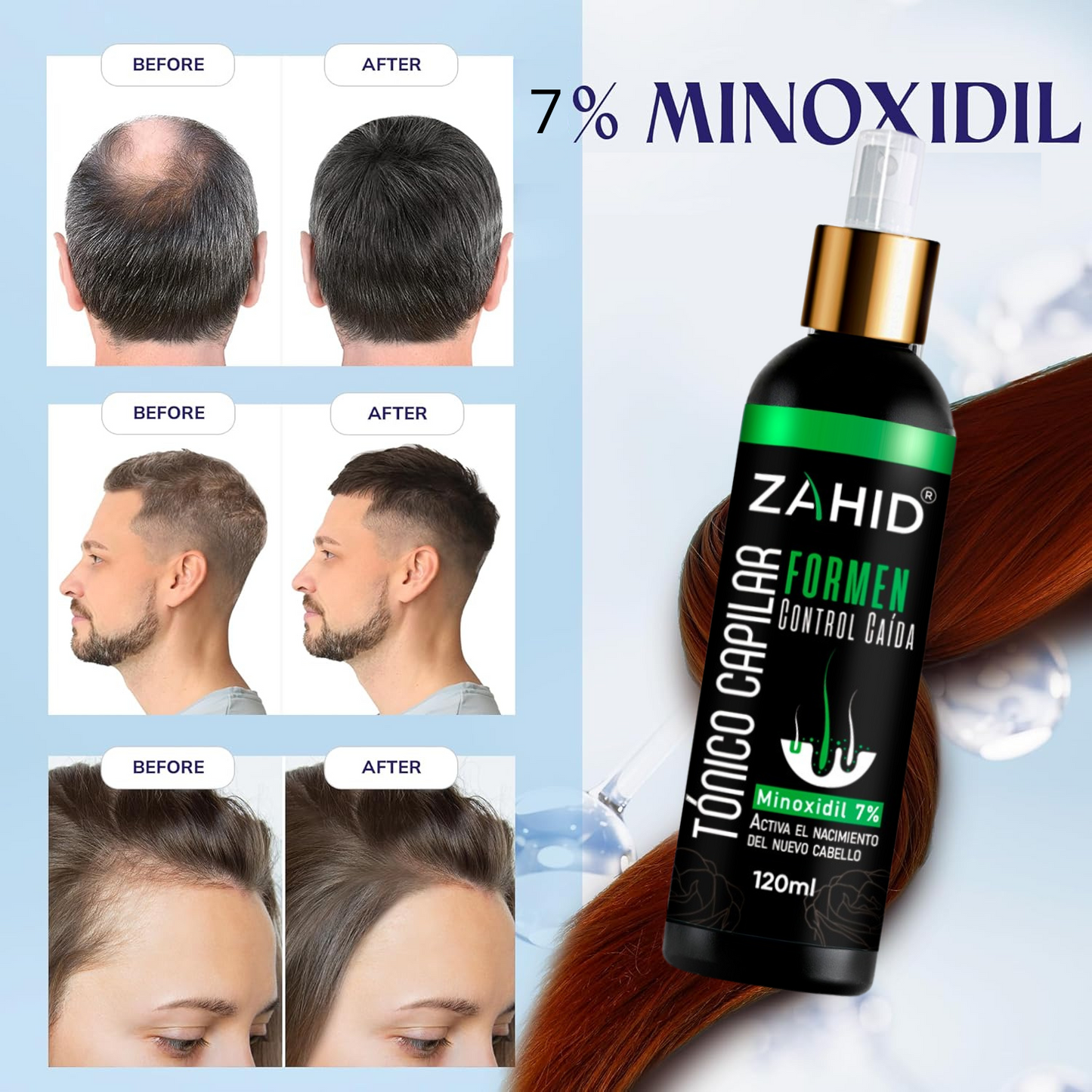 REVITALIZADOR ZAHID HAIRFORCE® MAX
